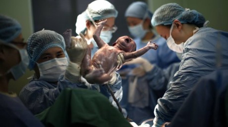 Рождение ребенка. Фото REUTERS©