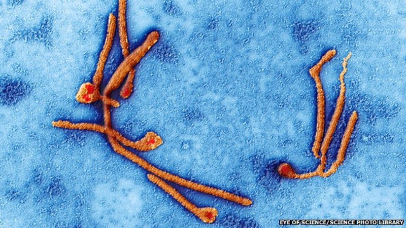 Вирус Эбола под микроскопом. © bbc.co.uk
