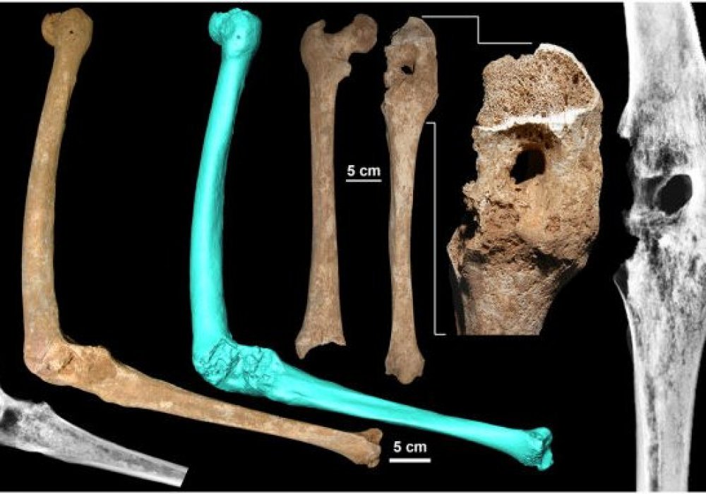 Кости, найденные в комплексе захоронений в Вергине. © livescience.com