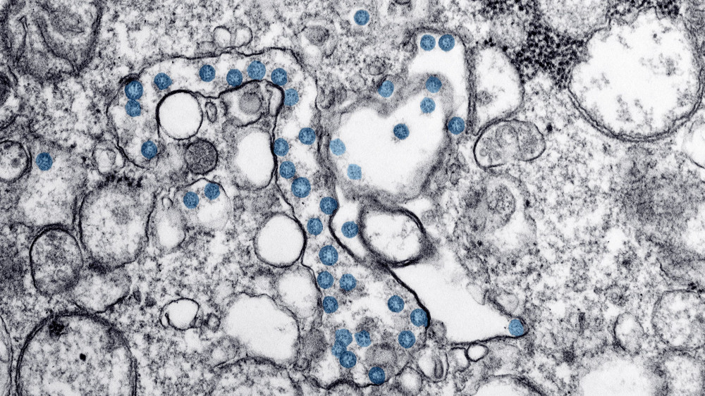 Так выглядит коронавирус в электронном микроскопе. © Reuters