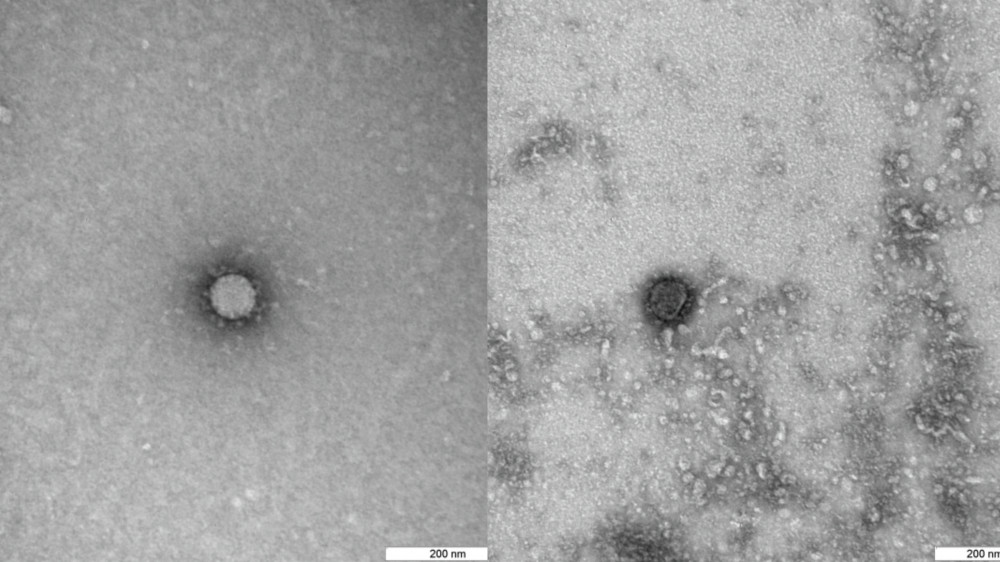 Фотографии коронавируса, сделанные российскими учеными с помощью электронного микроскопа. © РИА Новости